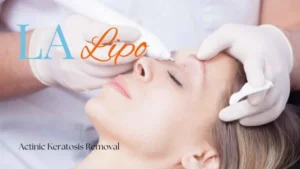 Woman receiving Actinic Keratosis Removal Treatment Stratford-upon-Avon
