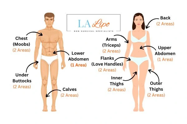 LA LIPO Cryolipolysis Areas Stratford-upon-Avon
