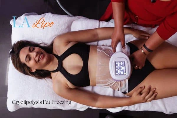 woman getting cryolipolysis Stratford-upon-Avon