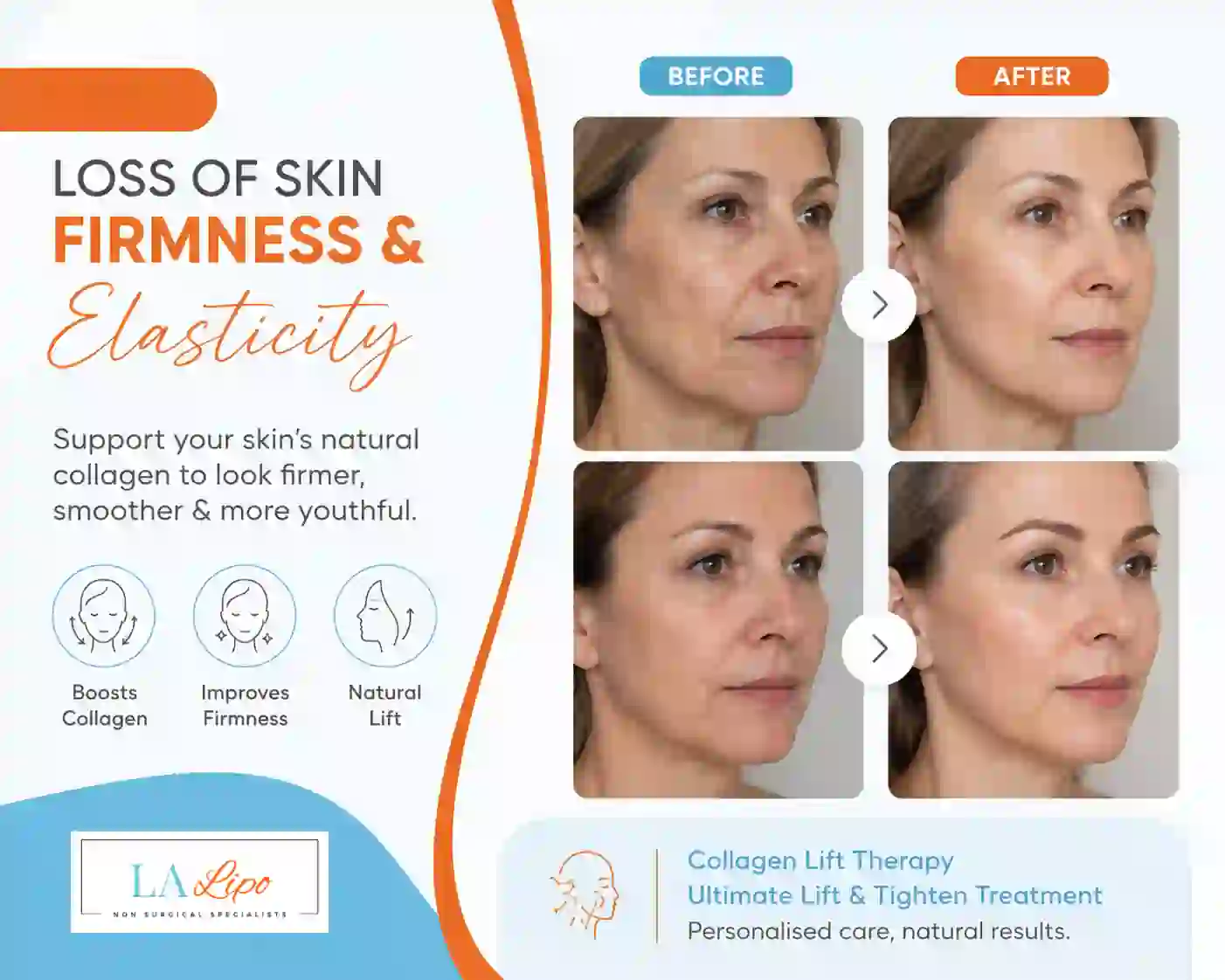 Sign #7: Loss of Skin Firmness and Elasticity Stratford-upon-Avon